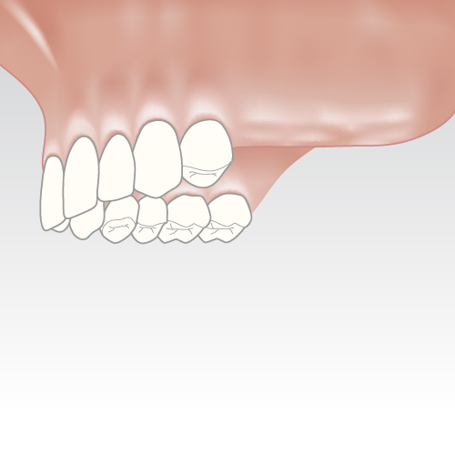 Šoninių dantų sritis